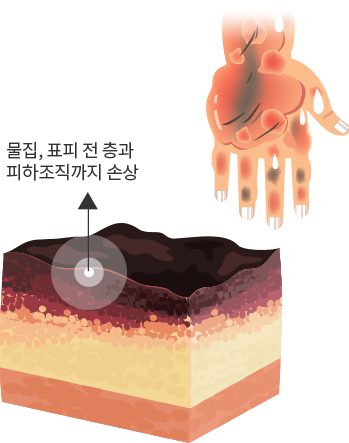 3도 화상(전층 화상) 이미지